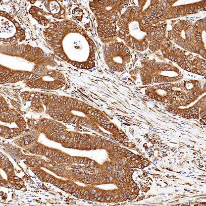 P4HB Recombinant Rabbit mAb (S-1524-120)