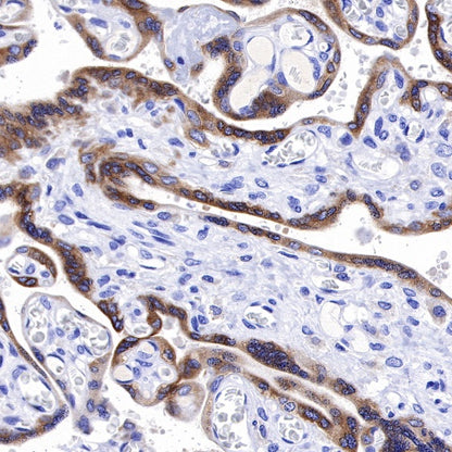 IMP-3 Recombinant Rabbit mAb (S-439-10)