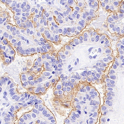 B7-H6 Recombinant Rabbit mAb (SDT-3241-6)