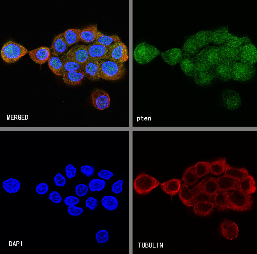 PTEN Recombinant Rabbit mAb (SDT-R074)