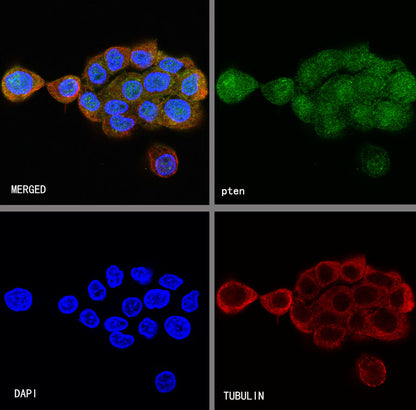 PTEN Recombinant Rabbit mAb (SDT-R074)