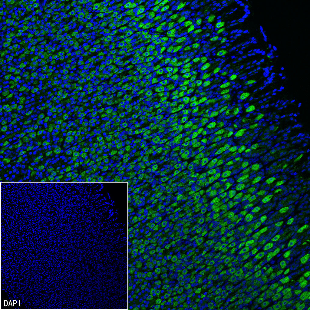 CHCHD10 Recombinant Rabbit mAb (S-4106-13)