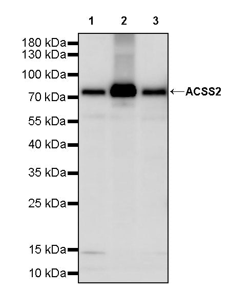 ACSS2 Recombinant Rabbit mAb (S-4117-9)