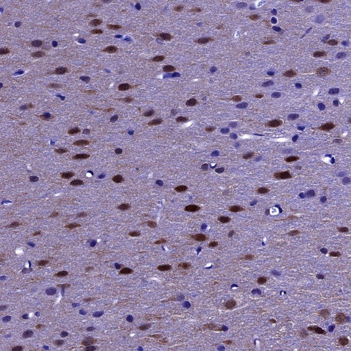 DARPP32 Recombinant Rabbit mAb (S-1637-62)