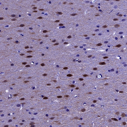 DARPP32 Recombinant Rabbit mAb (S-1637-62)