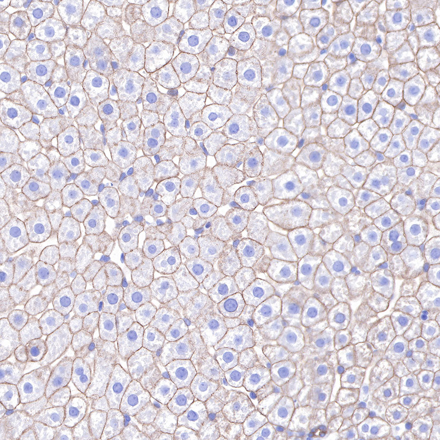 S-RMab® Keratin 18 Recombinant Rabbit mAb (SDT-012-7)