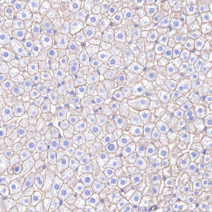 S-RMab® Keratin 18 Recombinant Rabbit mAb (SDT-012-7)