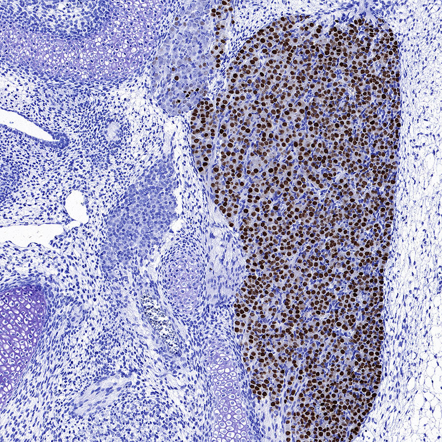 BRN3A Recombinant Rabbit mAb (S-3253-25)