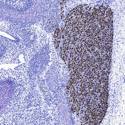 BRN3A Recombinant Rabbit mAb (S-3253-25)