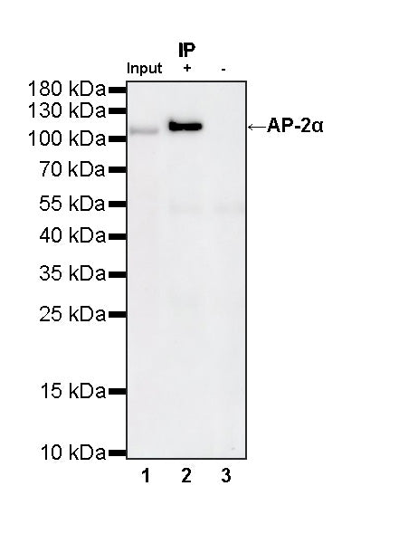 AP-2α Recombinant Rabbit mAb (S-4444-44)