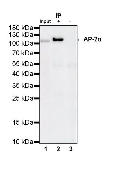 AP-2α Recombinant Rabbit mAb (S-4444-44)