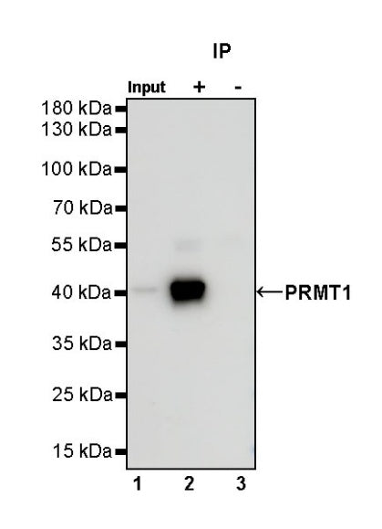 PRMT1 Recombinant Rabbit mAb (S-884-10)