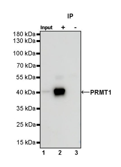 PRMT1 Recombinant Rabbit mAb (S-884-10)