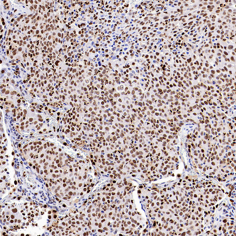 TBX18 Recombinant Rabbit mAb (S-4619-17)