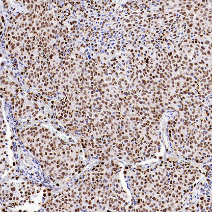 TBX18 Recombinant Rabbit mAb (S-4619-17)