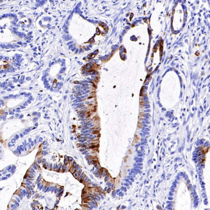 TFF1 Recombinant Rabbit mAb (S-336-75)