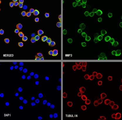MMP3 Recombinant Rabbit mAb