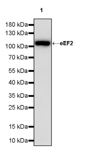eEF2 Recombinant Rabbit mAb (S-1976-35)