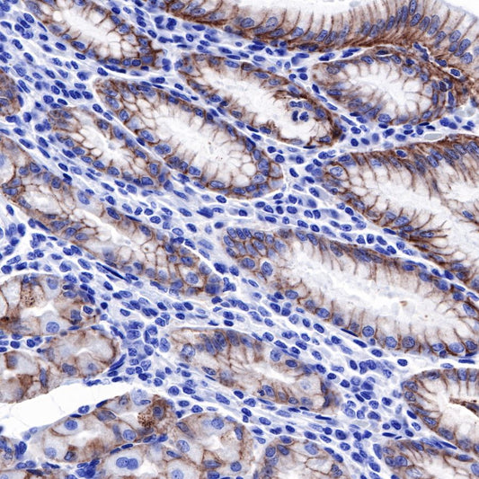 Anti-Rabbit and Mouse HRP&DAB IHC detection kit