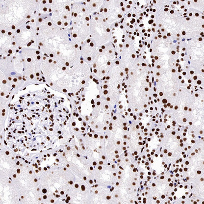 HDAC2 Recombinant Rabbit mAb (S-1474-27)