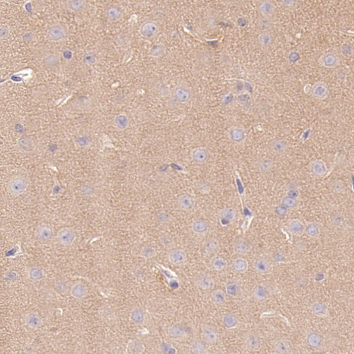 PPP2R1A Rabbit Polyclonal Antibody