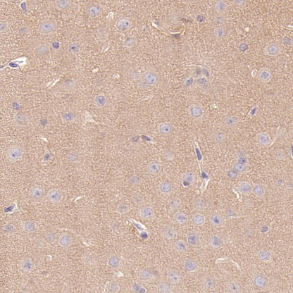PPP2R1A Rabbit Polyclonal Antibody