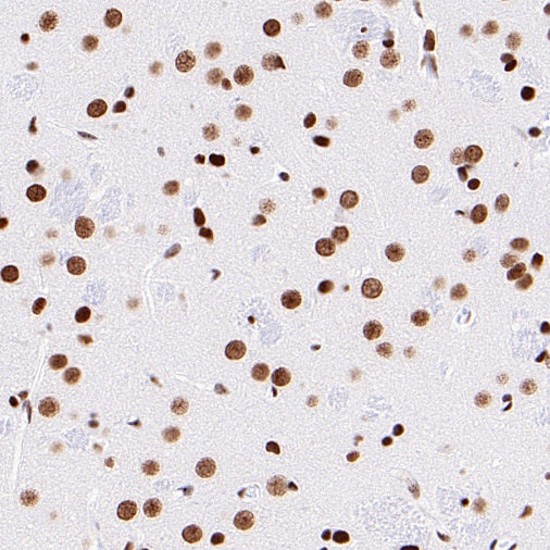 SUMO-1 Recombinant Rabbit mAb (S-625-111)