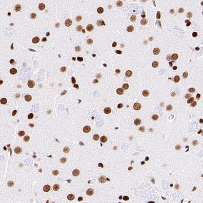SUMO-1 Recombinant Rabbit mAb (S-625-111)