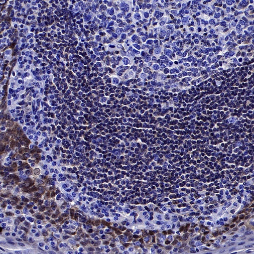 SMAD3 Recombinant Rabbit mAb (S-517-122)