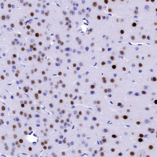 EGR2 Recombinant Rabbit mAb (S-741-136)