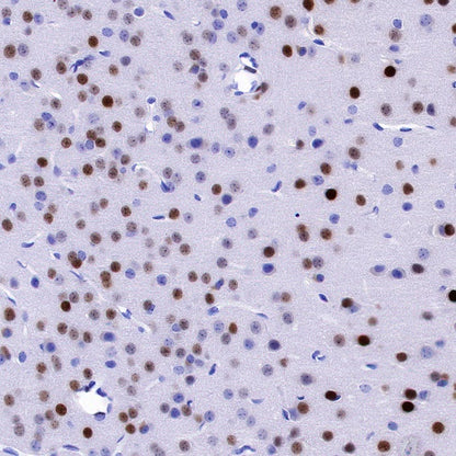 EGR2 Recombinant Rabbit mAb (S-741-136)