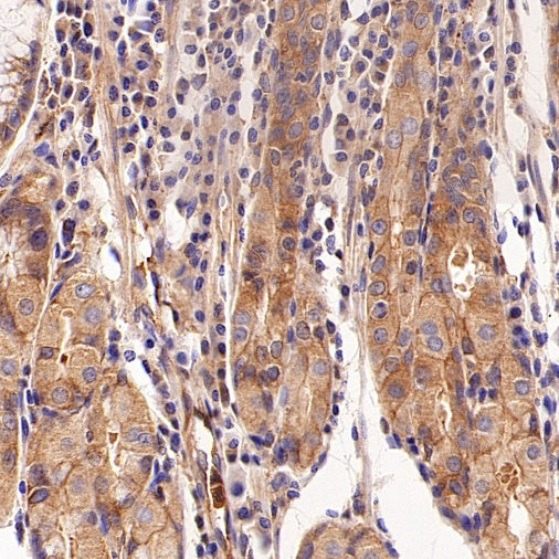 EEA1 Recombinant Rabbit mAb (S-2604-39)