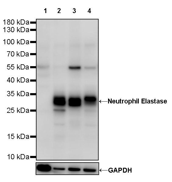 Neutrophil Elastase Recombinant Rabbit mAb (S-R230)