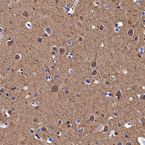 YWHAH/14-3-3 eta Recombinant Rabbit mAb (S-1327-22)