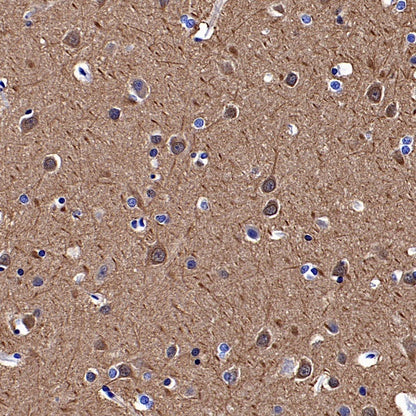 YWHAH/14-3-3 eta Recombinant Rabbit mAb (S-1327-22)