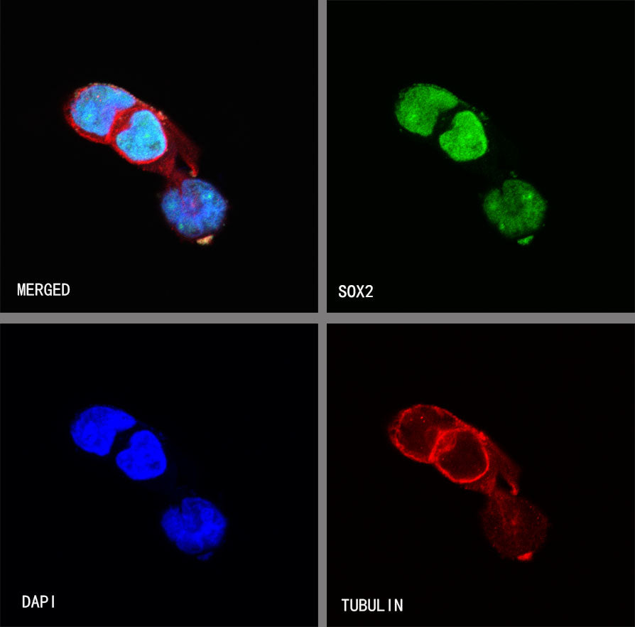SOX2 Recombinant Rabbit mAb(SDT-066-58)