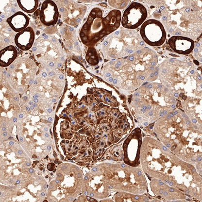 p38 MAPK Recombinant Rabbit mAb (S-508-19)