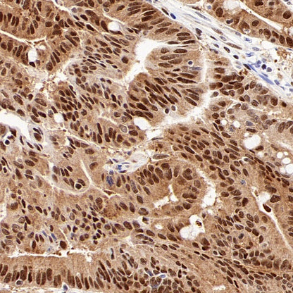 PGC1 beta Recombinant Rabbit mAb (S-1212-146)