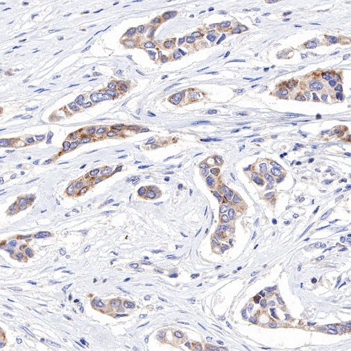 MCL1 Recombinant Rabbit mAb (S-772-109)