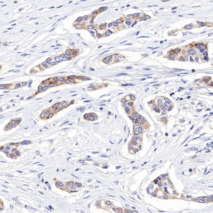 MCL1 Recombinant Rabbit mAb (S-772-109)