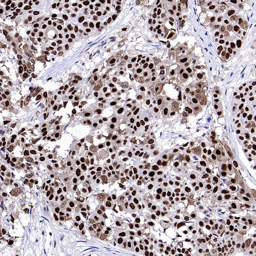 TKT Rabbit Polyclonal Antibody