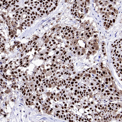 TKT Rabbit Polyclonal Antibody