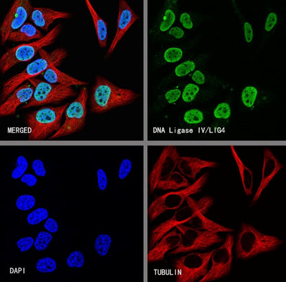 DNA Ligase IV/LIG4 Recombinant Rabbit mAb (S-2237-118)