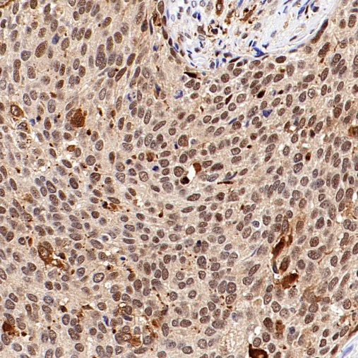 PGC1 beta Recombinant Rabbit mAb (S-1212-146)