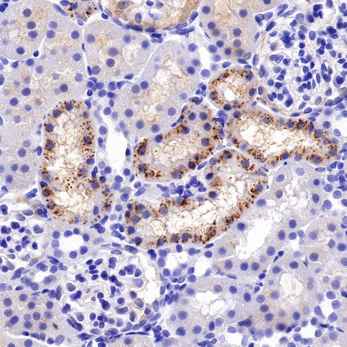 IFIT1 Recombinant Rabbit mAb (S-962-58)