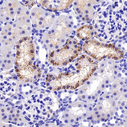 IFIT1 Recombinant Rabbit mAb (S-962-58)