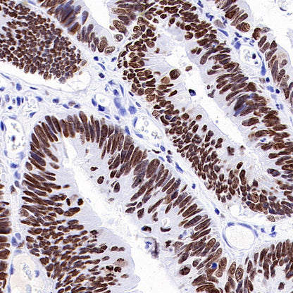 HMGA1 Recombinant Rabbit mAb (S-R332)