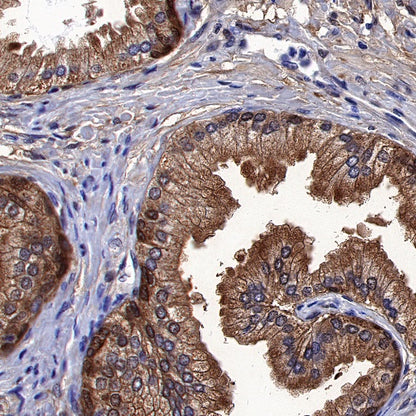MIF Recombinant Rabbit mAb (S-1007-34)