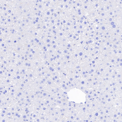 CAIX Recombinant Rabbit mAb (SDT-356-21)