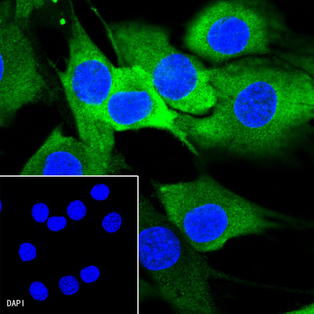 Stathmin 1 Recombinant Rabbit mAb (SDT-383-4)